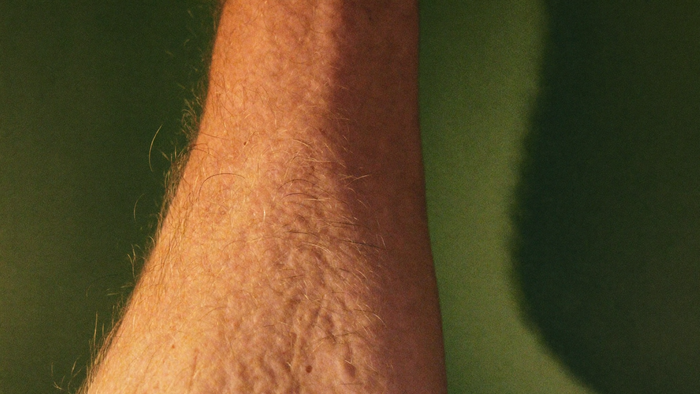 Nahaufnahme eines Unterarms mit Gänsehaut und aufgestellten Härchen im warmen Kerzenlicht