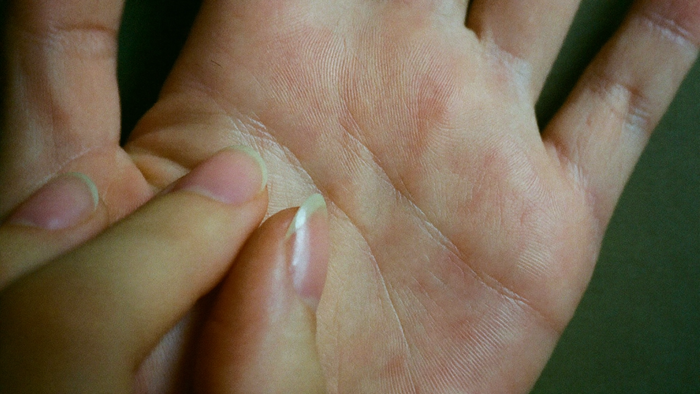 Nahaufnahme: Fingernägel kratzen über eine juckende Handfläche – Titelbild zu „Linke Hand juckt“